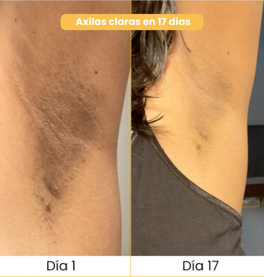 Turmica - La solución natural contra las manchas