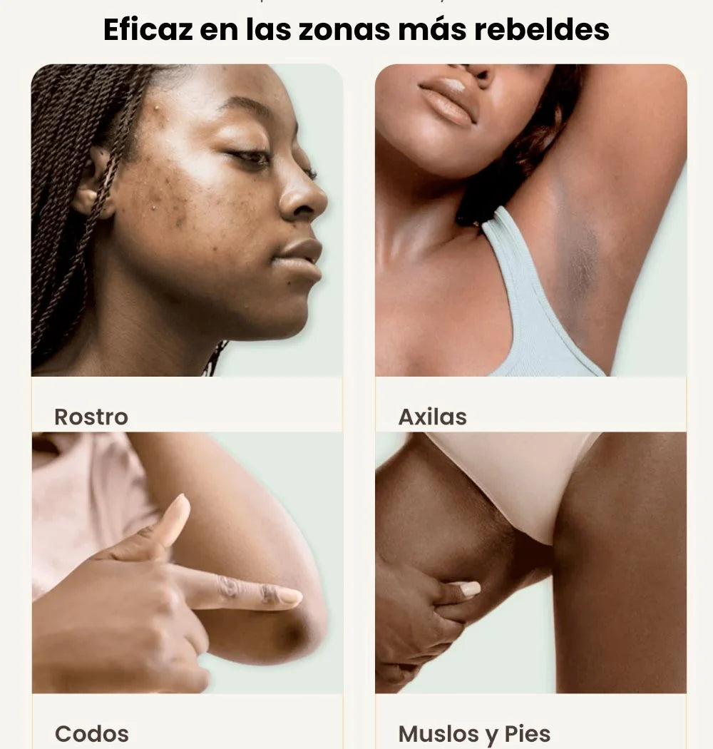 Turmica - La solución natural contra las manchas