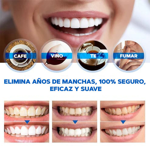 Blanqueador Dental - ToothWhitener®