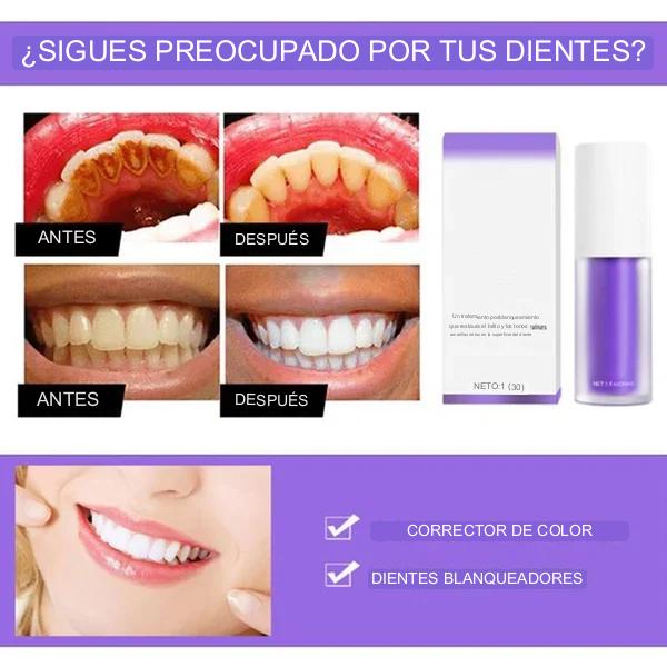 SMILEKIT™ - Nuevo V34 Series Pasta de dientes Corrector de color púrpura
