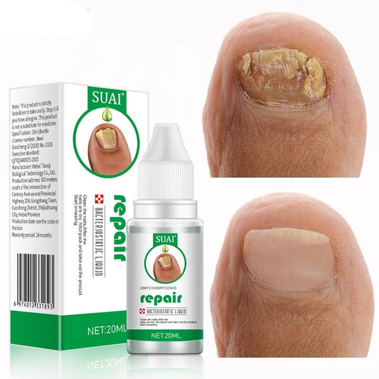 Repair eliminador de hongos y Reparador de uñas