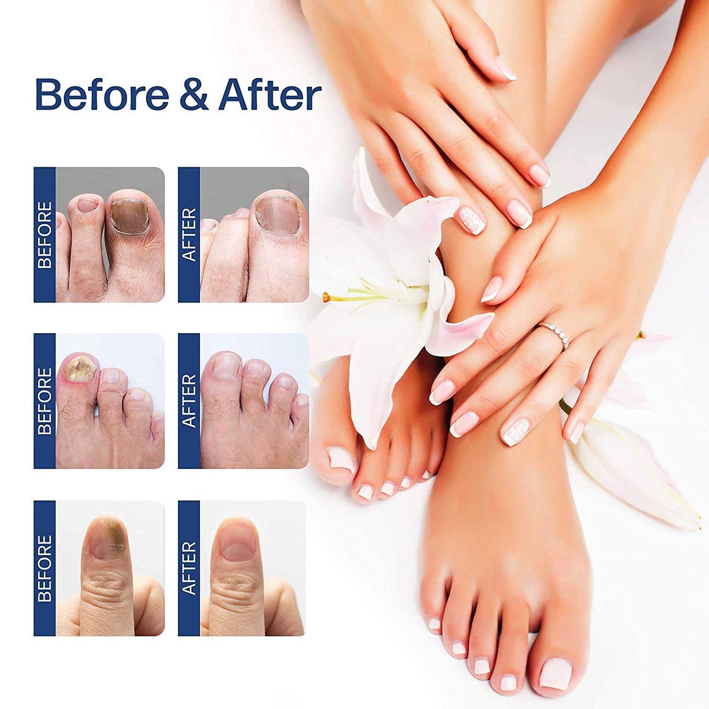 Repair eliminador de hongos y Reparador de uñas