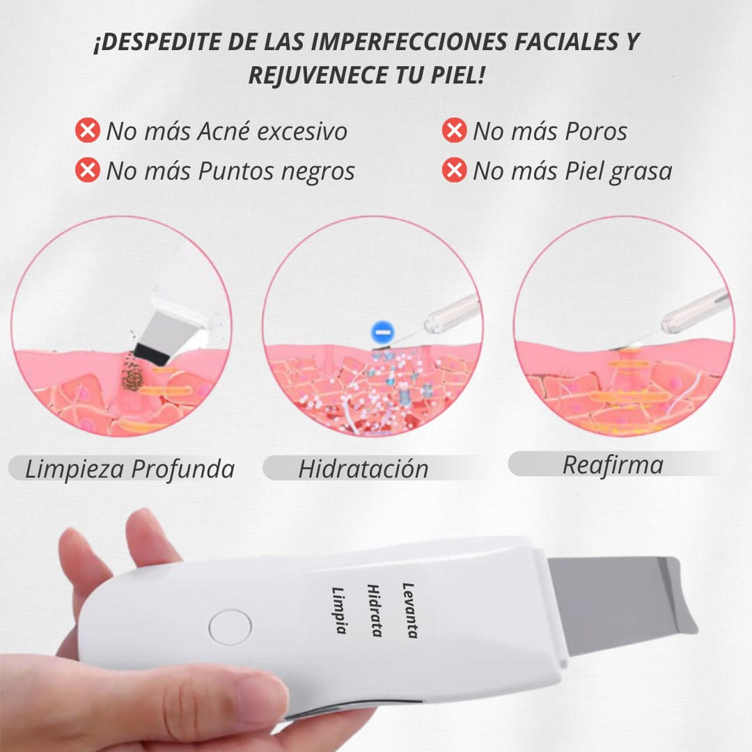 Limpiador facial inalámbrico para remover puntos negros