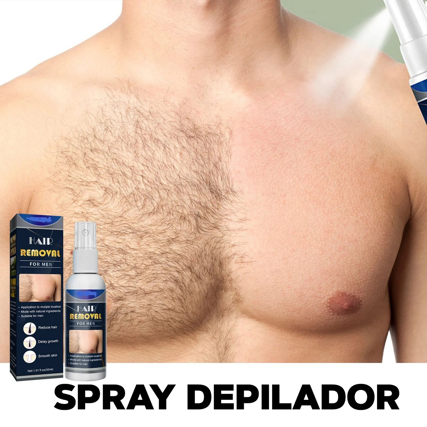 Spray depilador - SkinDepilator™