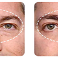 GEL PARA CONTORNO DE OJOS - OPEN-Eyes™
