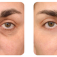 GEL PARA CONTORNO DE OJOS - OPEN-Eyes™