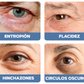GEL PARA CONTORNO DE OJOS - OPEN-Eyes™