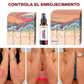 SPRAY CONTRA LA PSORIASIS - NOTPSORIASIS™