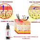 SPRAY CONTRA LA PSORIASIS - NOTPSORIASIS™