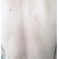 SPRAY CONTRA LA PSORIASIS - NOTPSORIASIS™
