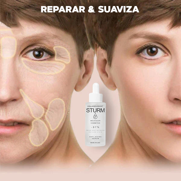 Serum anti-envejecimiento acido Hialuronico - STURM®