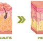 PARCHES REDUCTORES DE CELULITIS