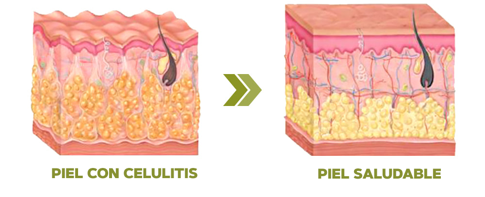 PARCHES REDUCTORES DE CELULITIS
