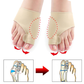 CALCETIN CORRECTOR DE JUANETES PREMIUM - HALLUXVALGUS™