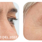 GEL PARA CONTORNO DE OJOS - OPEN-Eyes™