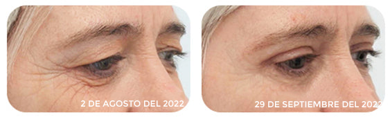 GEL PARA CONTORNO DE OJOS - OPEN-Eyes™