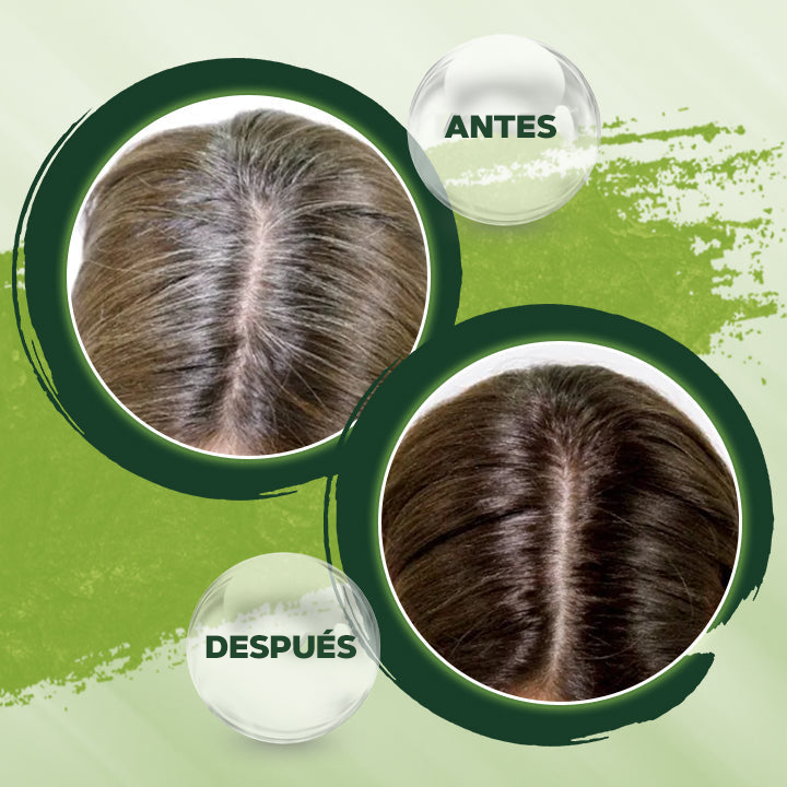 Barra de champú para oscurecer el cabello negro - HairMax™