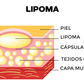 CREMA ELIMINADORA DE LIPOMAS - LIPOMFREE™