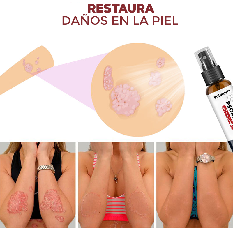 SPRAY CONTRA LA PSORIASIS - NOTPSORIASIS™