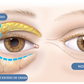GEL PARA CONTORNO DE OJOS - OPEN-Eyes™