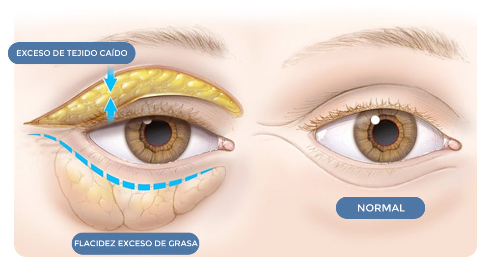 GEL PARA CONTORNO DE OJOS - OPEN-Eyes™