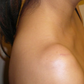 CREMA ELIMINADORA DE LIPOMAS - LIPOMFREE™