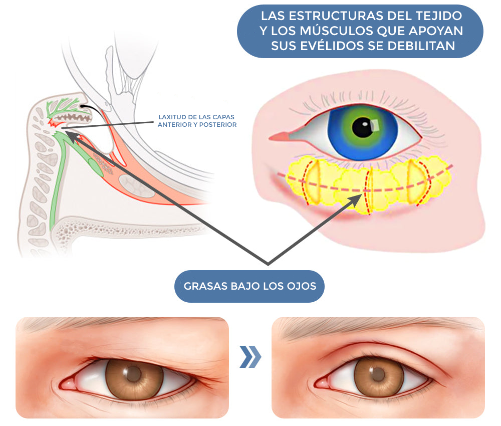 GEL PARA CONTORNO DE OJOS - OPEN-Eyes™