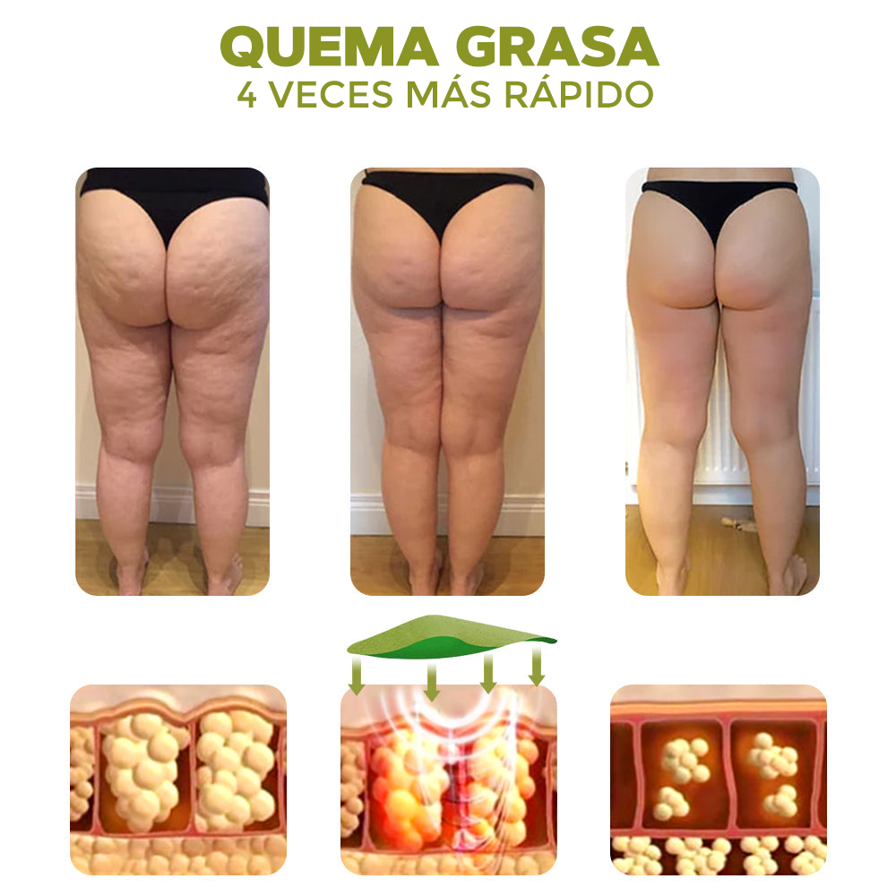 PARCHES REDUCTORES DE CELULITIS