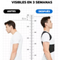 Corrector de postura Ergonómico - FurPosture™
