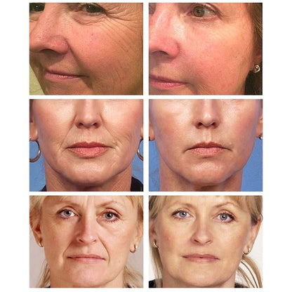 ÁCIDO HIALURÓNICO ANTI EDAD CON ORO - 24K™