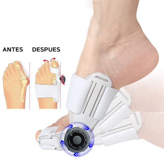 Corrector ortopédico de juanetes - Hallux Foot™