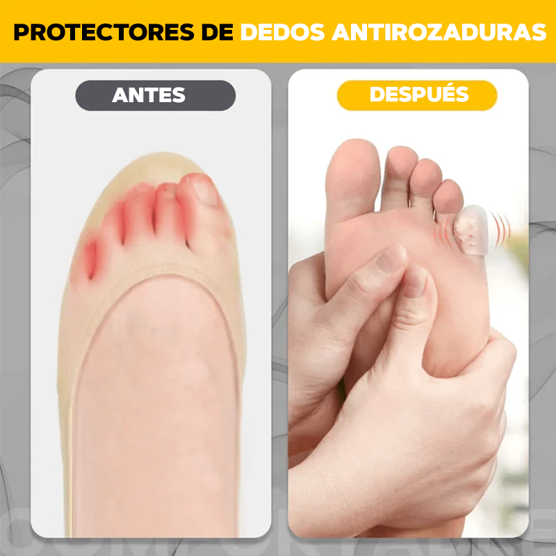 Protector de dedos anti-friccion - ToeProtector™