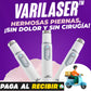 VARILASER - Piernas libres de varices y arañas vasculares